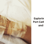 Exploring the Risks of Port Catheter Fracture and Migration